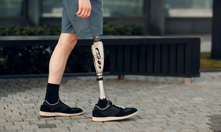 ЗА МОШЕННИЧЕСТВО С ПРОТЕЗОМ